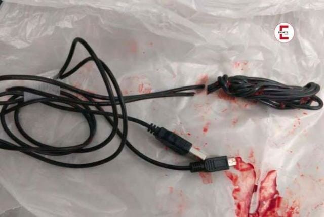 15-Jähriger steckt sich ganzes USB-Kabel in den Penis